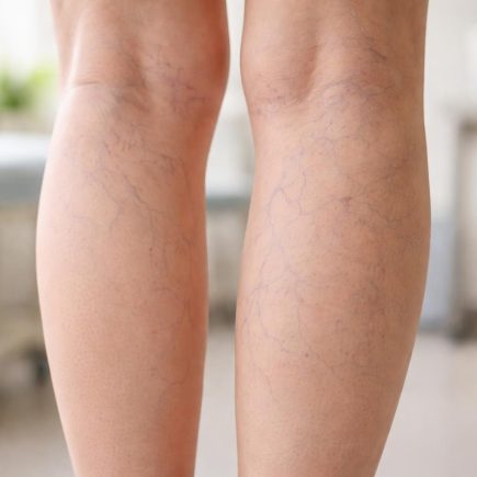 jambes-marbre-flou-examen-medical